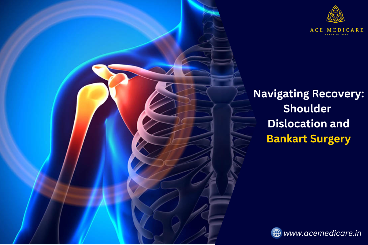Navigating Recovery: Shoulder Dislocation and Bankart Surgery